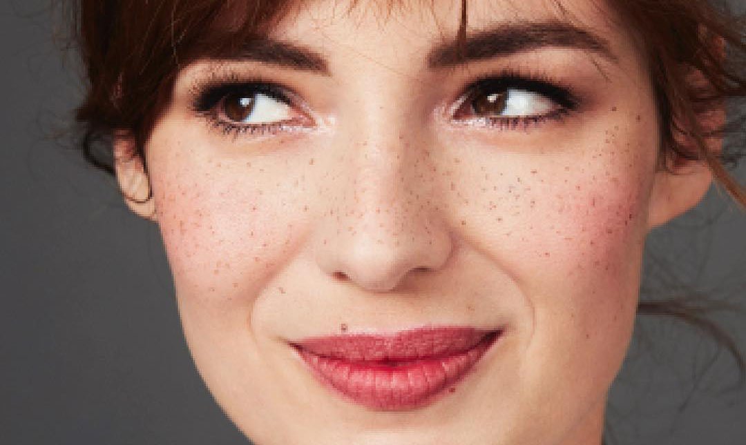 Cómo disimular la hiperpigmentación con maquillaje | L’Oréal Paris